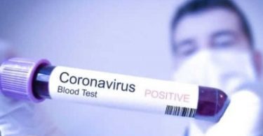 НАН погіршила прогноз щодо COVID-епідемії в Україні